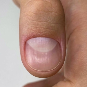 Close-up of a fingernail